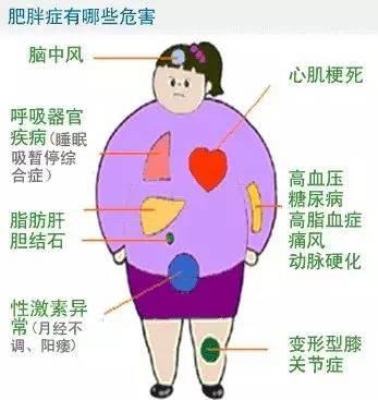 �����M�X